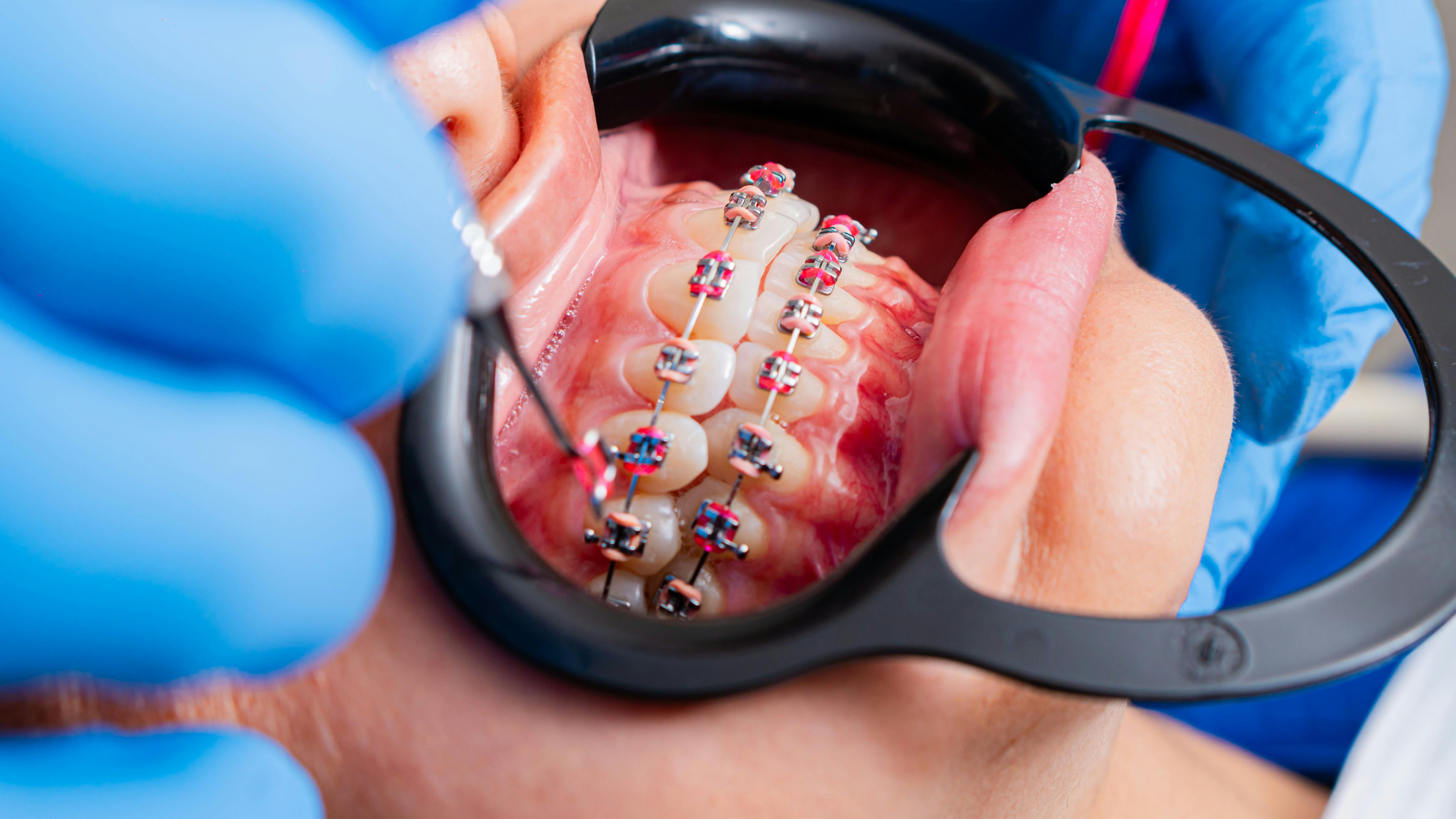 Tratamento odontológico planejado na Clínica Specialis