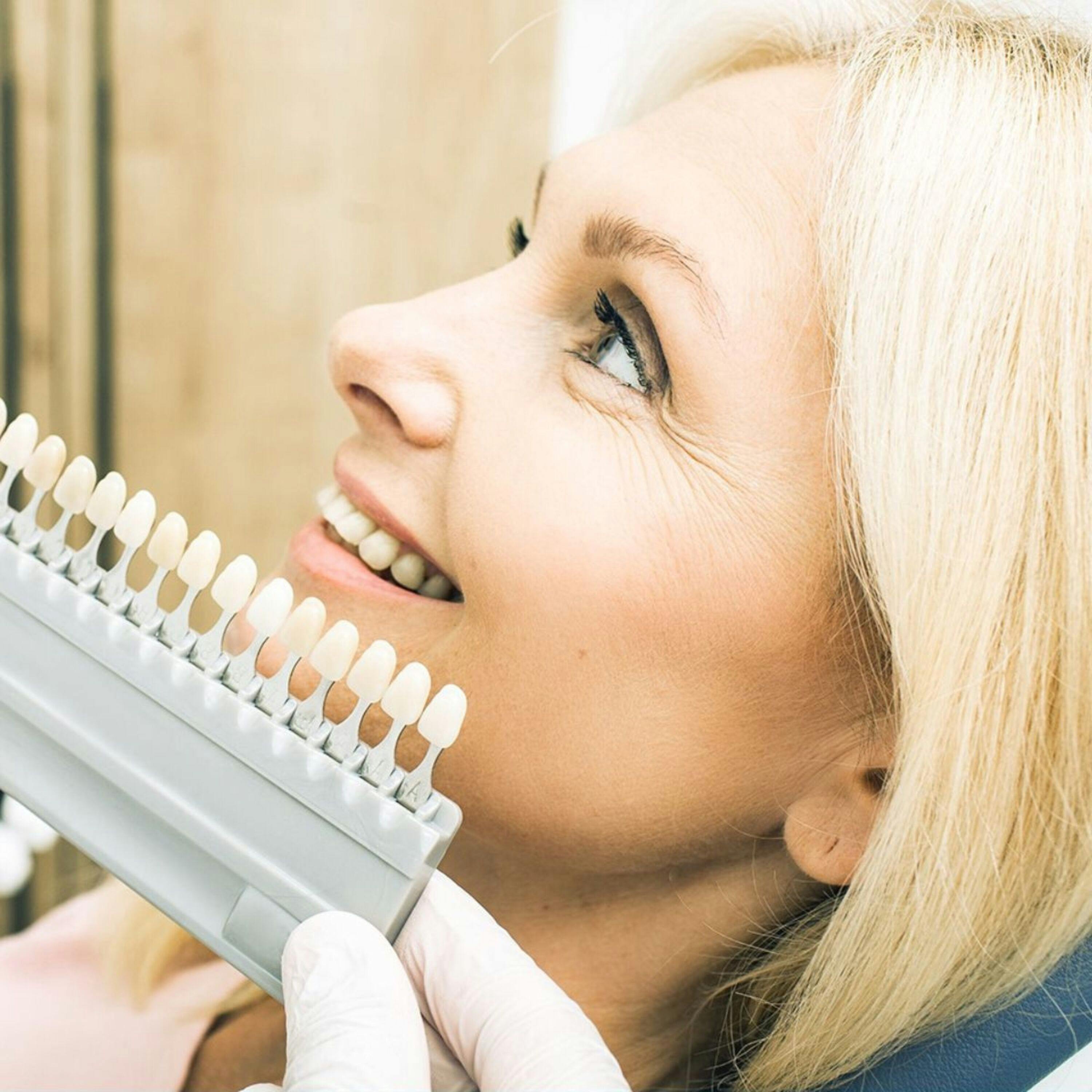Clareamento dental na Specialis