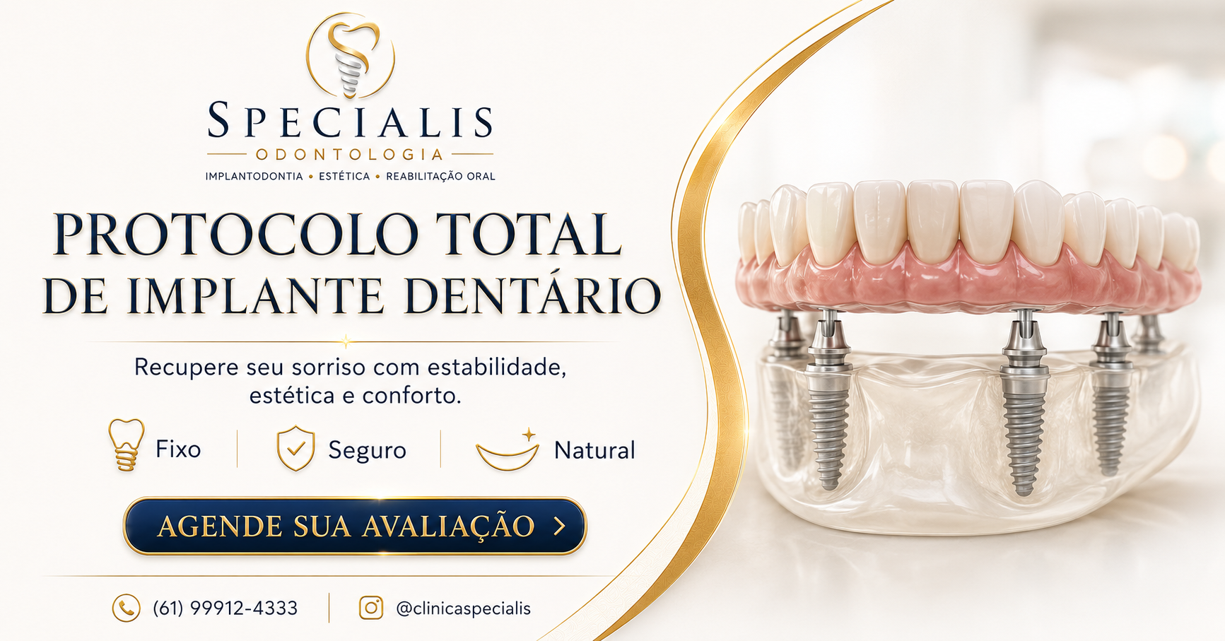Protocolo total de implante dentário na Specialis